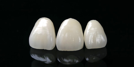 ジルコニアセラミッククラウン